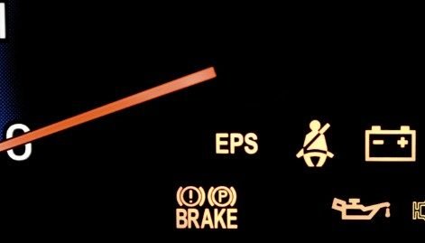 Kia Ceed Eps Warning Light